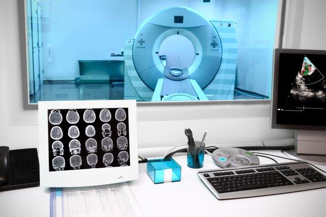  بررسی بهتر مغز بیماران اسکیزوفرنیک با روش تصویربرداری جدید