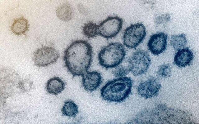 ابزاری که می‌تواند عفونت ناشی از کروناویروس را تشخیص دهد