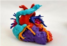 ساخت قلب چاپ سه‌بعدی برای کاهش جراحی‌های قلب کودکان 