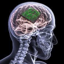 افزایش قدرت حافظه با ایمپلنت‌های مغزی 